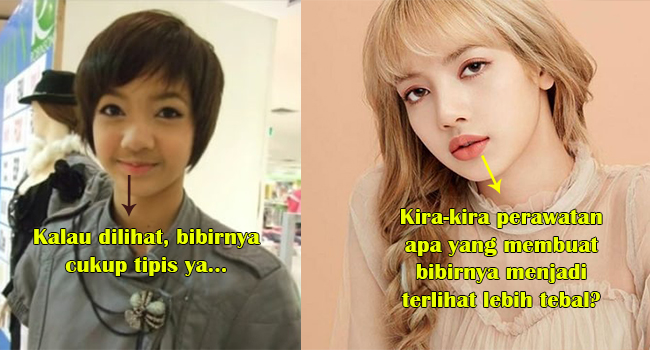 Apakah Bibir Lisa BLACKPINK Oplas? Lihat Perbandingan ...